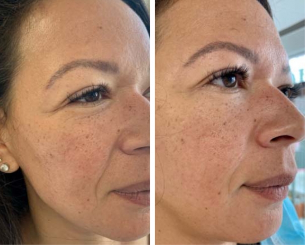 RD Cosmetic avant-après